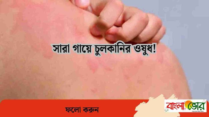 সারা গায়ে চুলকানি ঔষধ
