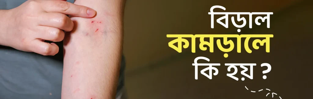 বিড়াল কামড়ালে বা আঁচড় দিলে করণীয় কি