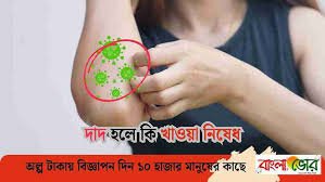 দাদ হলে কি খাওয়া নিষেধ