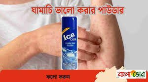 ঘামাচি পাউডার কোনটা ভালো